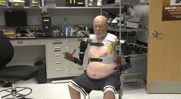 Double-Amputee Gets Two Badass Robot Arms